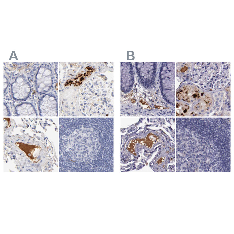 Immunohistochemical staining of human colon, kidney, lung and lymph node using Anti-APOH antibody HPA003732 (A) shows similar protein distribution across tissues to independent antibody HPA001654 (B).