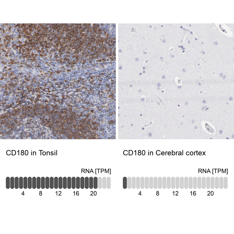 Immunohistochemistry analysis in human tonsil and cerebral cortex tissues using Anti-CD180 antibody. Corresponding CD180 RNA-seq data are presented for the same tissues.