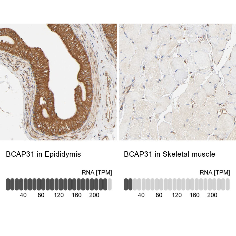 Immunohistochemistry analysis in human epididymis and skeletal muscle tissues using Anti-BCAP31 antibody. Corresponding BCAP31 RNA-seq data are presented for the same tissues.