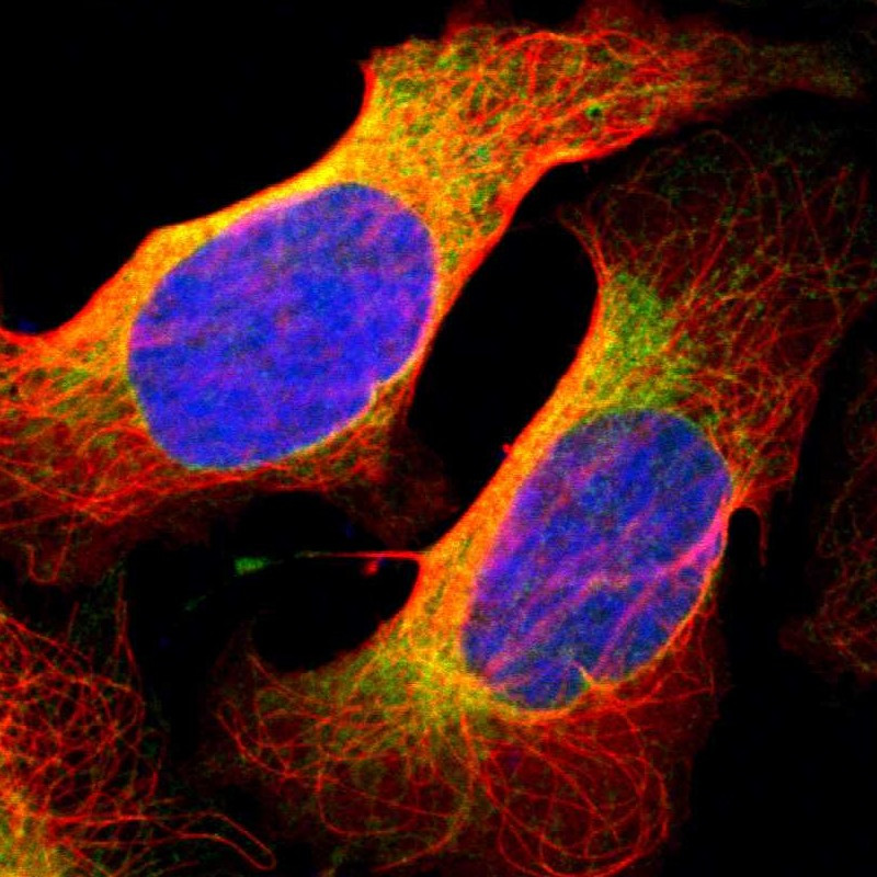 Immunofluorescent staining of human cell line U-2 OS shows localization to endoplasmic reticulum.