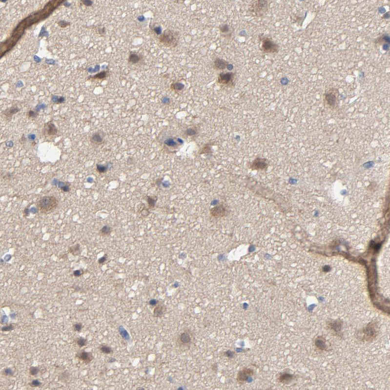 Immunohistochemical staining of human cerebral cortex shows moderate cytoplasmic positivity in neurons.
