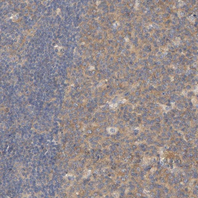 Immunohistochemical staining of human lymph node shows moderate cytoplasmic positivity in reaction center cells.