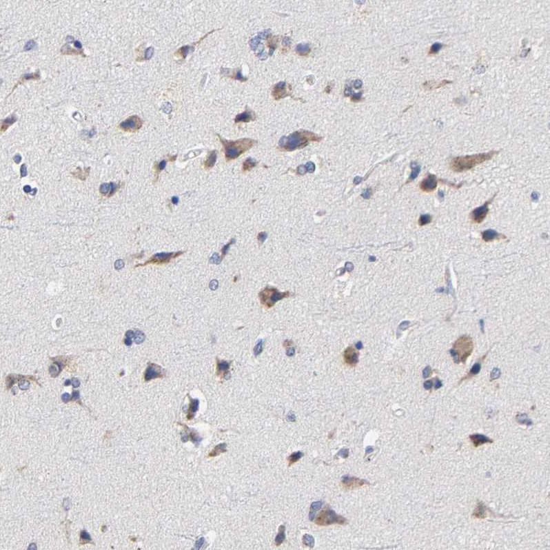 Immunohistochemical staining of human cerebral cortex shows moderate cytoplasmic positivity in neurons.