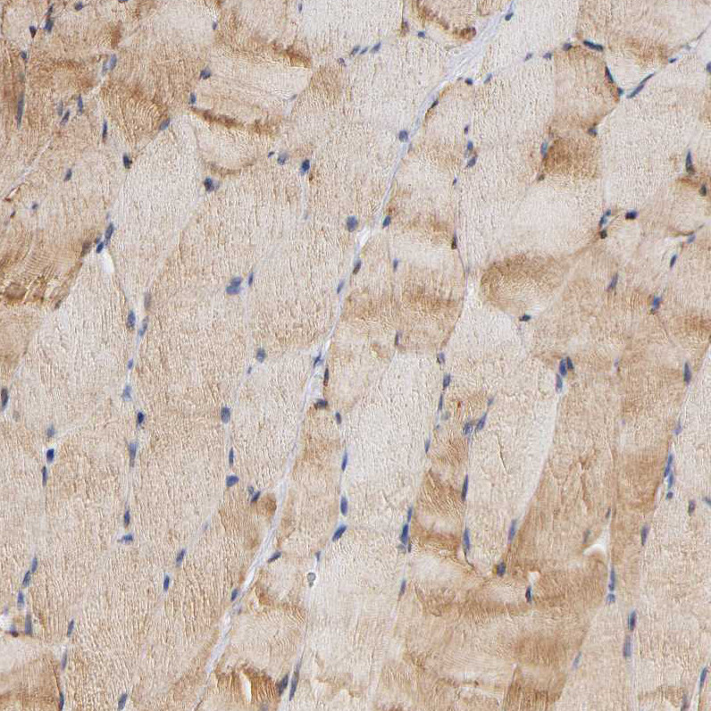 Immunohistochemical staining of human skeletal muscle shows moderate cytoplasmic positivity in myocytes.