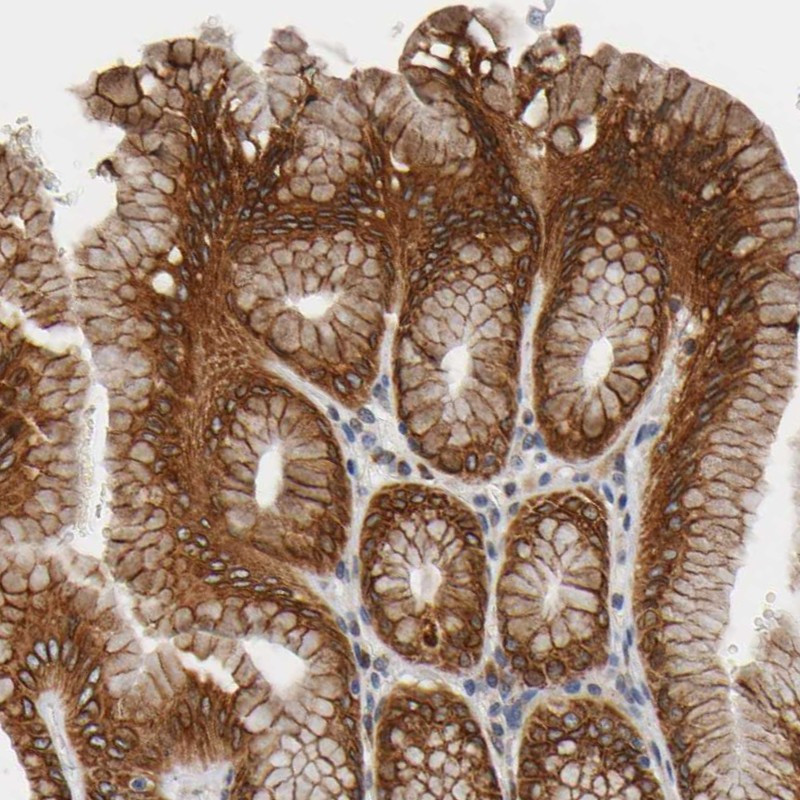 Immunohistochemical staining of human stomach shows strong cytoplasmic and membranous positivity in glandular cells.