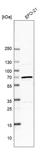 Western blot analysis in human cell line EFO-21.