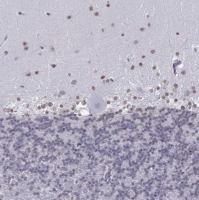 Immunohistochemical staining of human cerebellum shows weak nuclear positivity in cells in molecular layer.