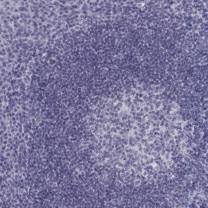 Immunohistochemical staining of human tonsil shows no positivity in non-germinal center cells as expected.