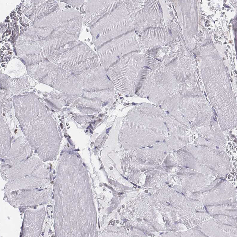 Immunohistochemical staining of human skeletal muscle shows no positivity in myocytes as expected.