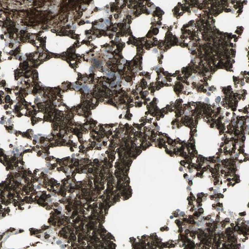 Immunohistochemical staining of human bone marrow shows strong positivity in erythrocytes and subsets of hematopoietic cells.