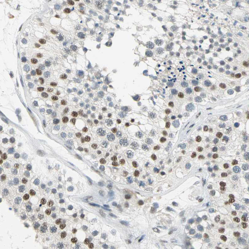 Immunohistochemical staining of human testis shows moderate nuclear positivity in cells in seminiferous ducts.