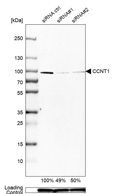 Western blot analysis in HeLa cells transfected with control siRNA, target specific siRNA probe #1 and #2, using Anti-CCNT1 antibody. Remaining relative intensity is presented. Loading control: Anti-GAPDH.