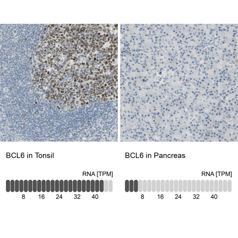 Immunohistochemistry analysis in human tonsil and pancreas tissues using HPA004899 antibody. Corresponding BCL6 RNA-seq data are presented for the same tissues.