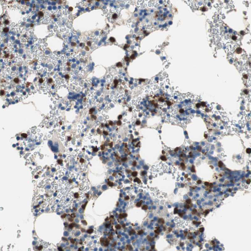 Immunohistochemical staining of human bone marrow shows moderate to strong cytoplasmic positivity in hematopoietic cells.