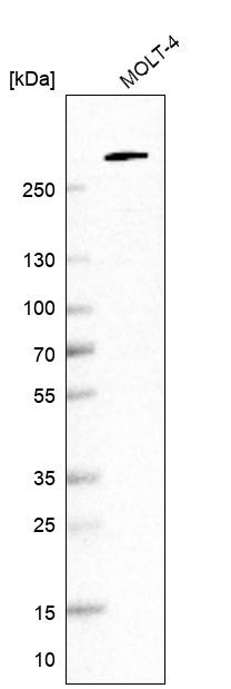 Western blot analysis in human cell line MOLT-4.