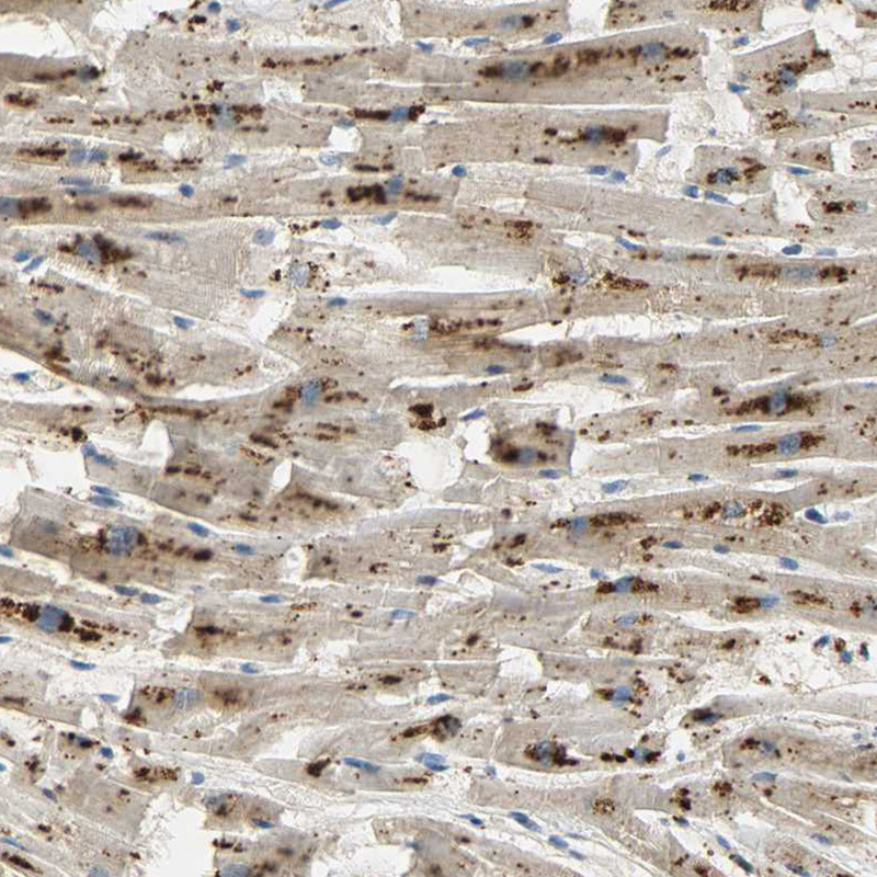Immunohistochemical staining of human heart muscle shows strong granular cytoplasmic positivity in cardiomyocytes.