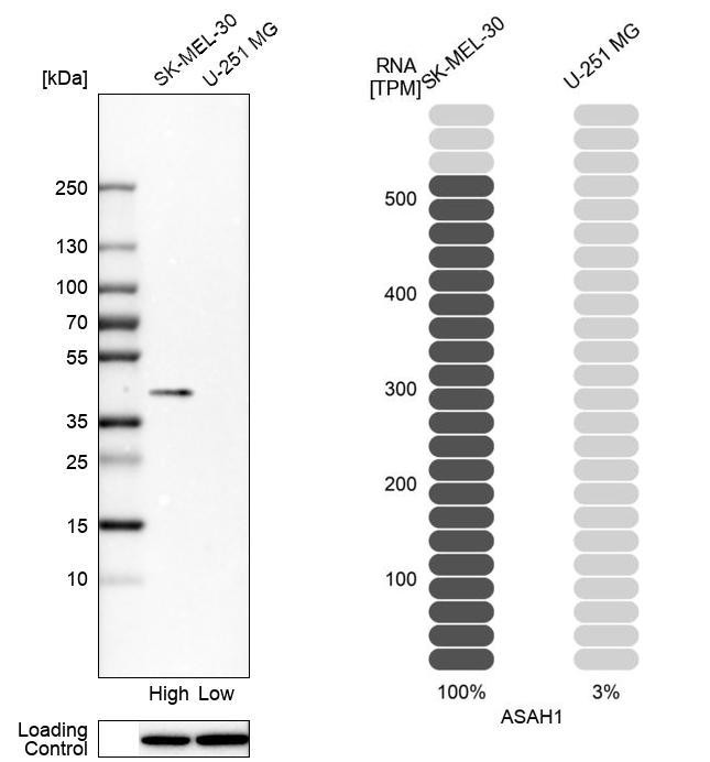 Western blot analysis in human cell lines SK-MEL-30 and U-251MG using Anti-ASAH1 antibody. Corresponding ASAH1 RNA-seq data are presented for the same cell lines. Loading control: Anti-HDAC1.