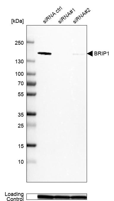 Western blot analysis in MCF-7 cells transfected with control siRNA, target specific siRNA probe #1 and #2, using Anti-BRIP1 antibody. Remaining relative intensity is presented. Loading control: Anti-GAPDH.