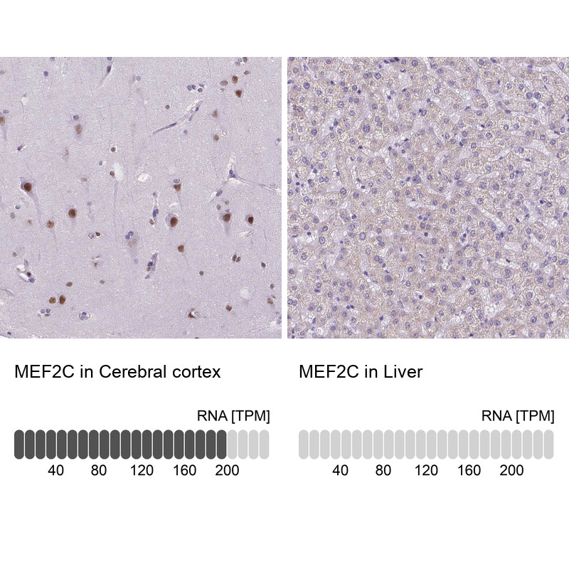 Immunohistochemistry analysis in human cerebral cortex and liver tissues using HPA005533 antibody. Corresponding MEF2C RNA-seq data are presented for the same tissues.