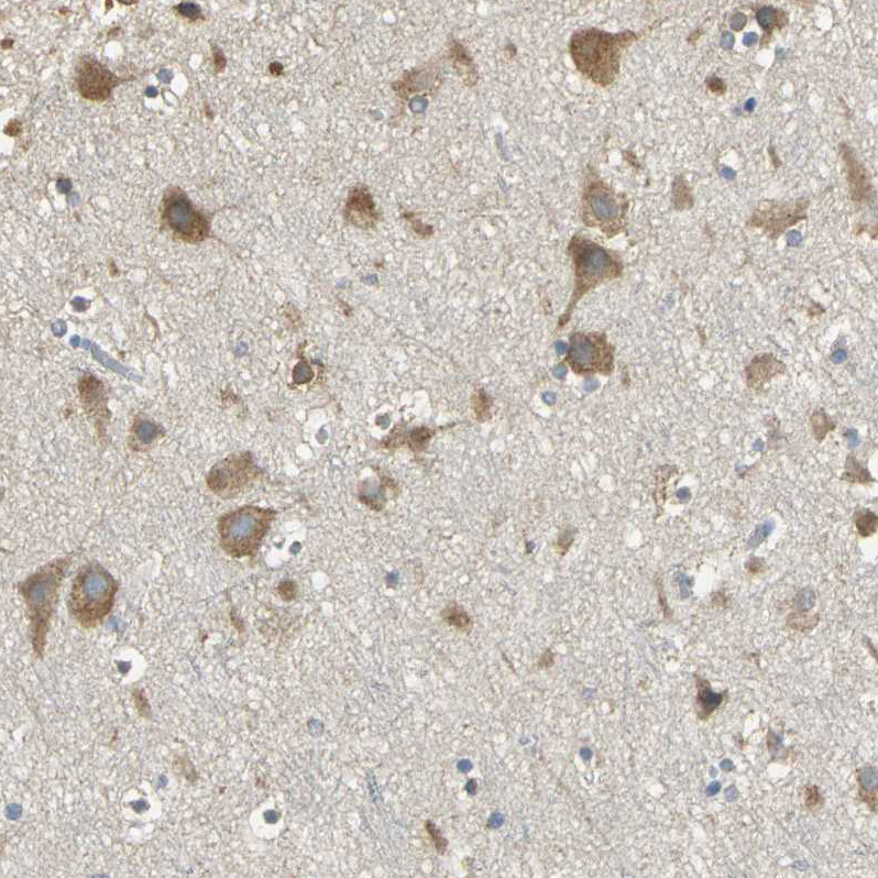 Immunohistochemical staining of human cerebral cortex shows moderate granular cytoplasmic positivity in neurons.
