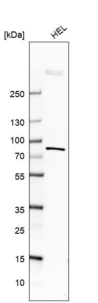 Western blot analysis in human cell line HEL.