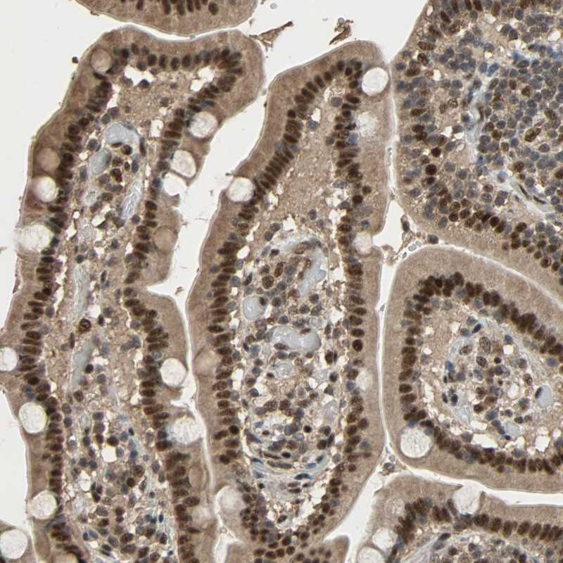 Immunohistochemical staining of human duodenum shows strong nuclear positivity in glandular cells.