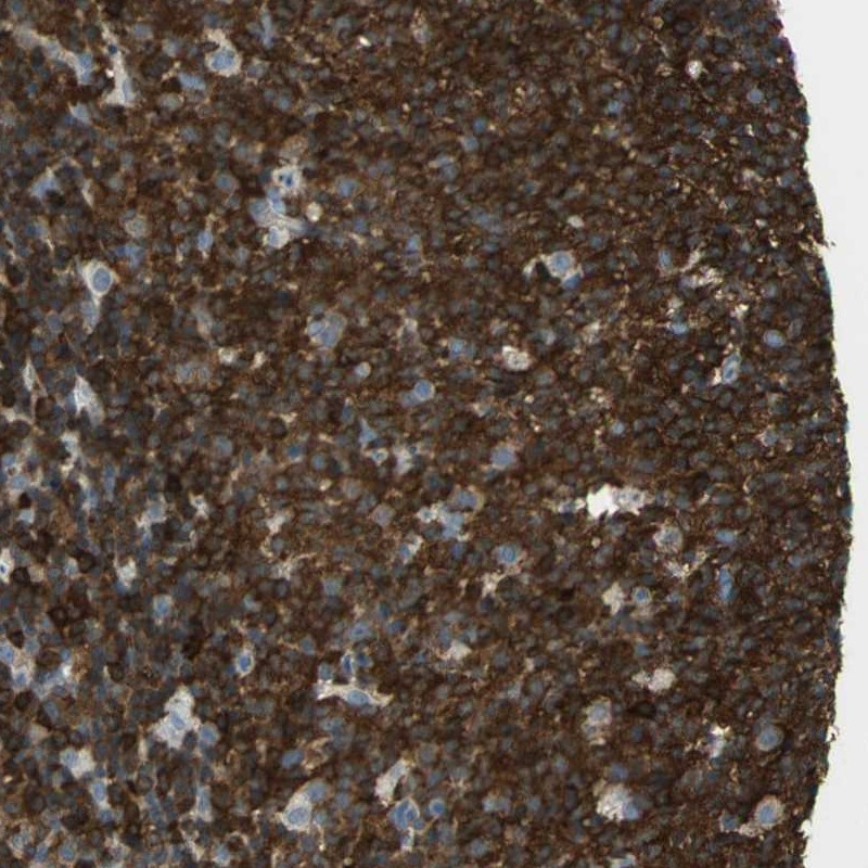 Immunohistochemical staining of human lymph node shows strong cytoplasmic positivity in reaction center cells.