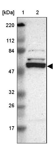 Lane 1: Marker [kDa] 220, 112, 84, 47, 32, 26, 17<br/>Lane 2: Human cell line RT-4