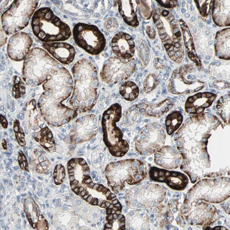 Immunohistochemical staining of human kidney shows strong cytoplasmic and membranous positivity in cells in tubules.