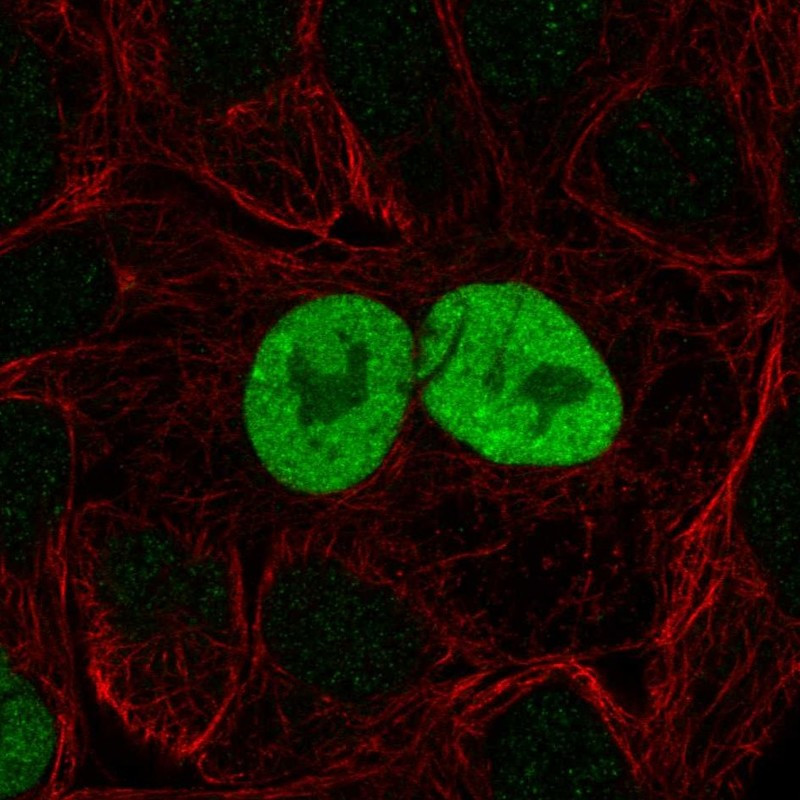 Immunofluorescent staining of human cell line RT4 shows localization to nucleoplasm.