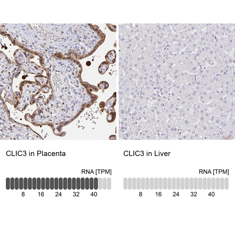 Immunohistochemistry analysis in human placenta and liver tissues using HPA005963 antibody. Corresponding CLIC3 RNA-seq data are presented for the same tissues.