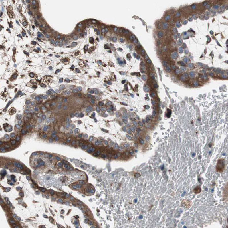 Immunohistochemical staining of human stomach shows strong cytoplasmic positivity in glandular cells.