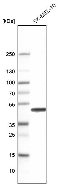 Western blot analysis in human cell line RT-4, human cell line U-251 MG, human plasma, human liver tissue and human tonsil tissue.