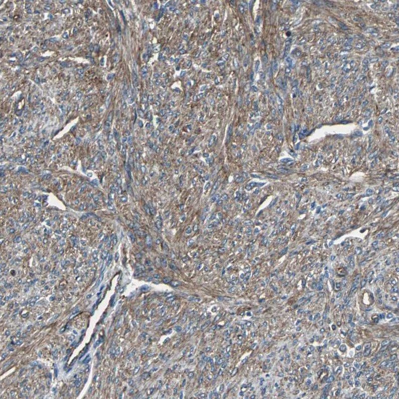Immunohistochemical staining of human smooth muscle shows cytoplasmic positivity in smooth muscle cells.