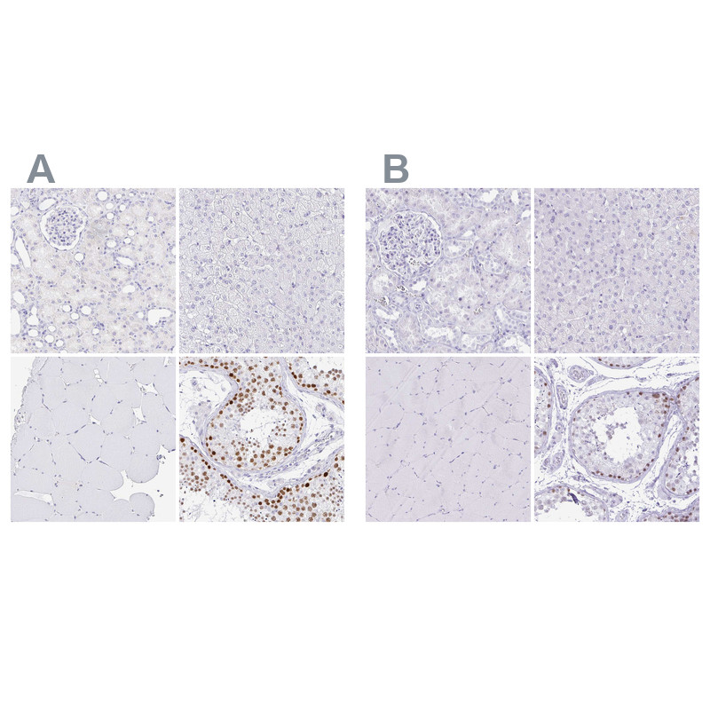 Immunohistochemical staining of human kidney, liver, skeletal muscle and testis using Anti-CXorf67 antibody HPA006128 (A) shows similar protein distribution across tissues to independent antibody HPA004003 (B).
