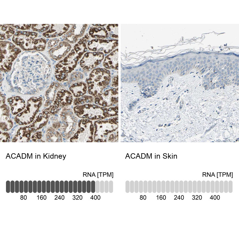 Immunohistochemistry analysis in human kidney and skin tissues using Anti-ACADM antibody. Corresponding ACADM RNA-seq data are presented for the same tissues.