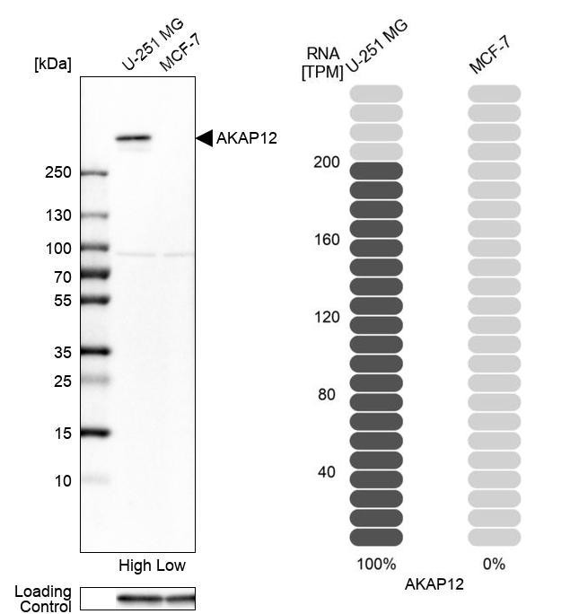 Western blot analysis in human cell line U-251 MG and human cell line MCF-7.
