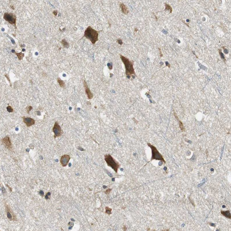 Immunohistochemical staining of human cerebral cortex shows strong cytoplasmic positivity in neuronal cells.
