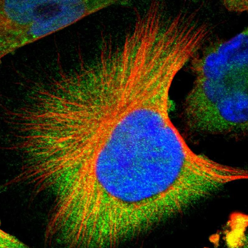 Immunofluorescent staining of human cell line U-251 MG shows localization to cytosol.