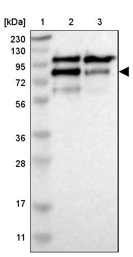 Lane 1: Marker [kDa] 230, 130, 95, 72, 56, 36, 28, 17, 11<br/>Lane 2: Human cell line RT-4<br/>Lane 3: Human cell line U-251MG sp
