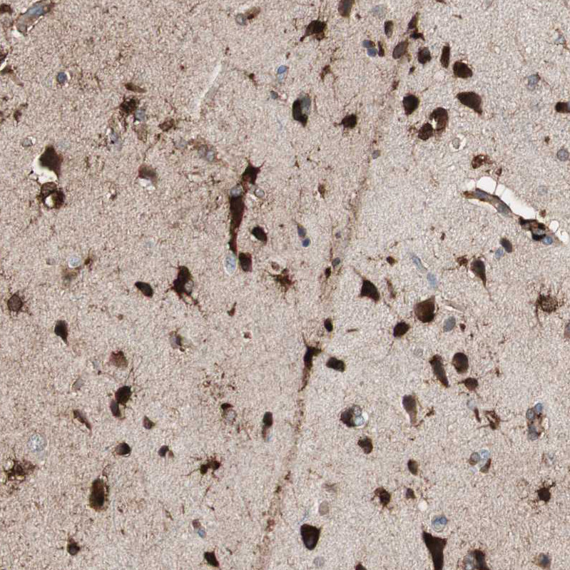 Immunohistochemical staining of human cerebral cortex shows strong cytoplasmic positivity in glial cells.