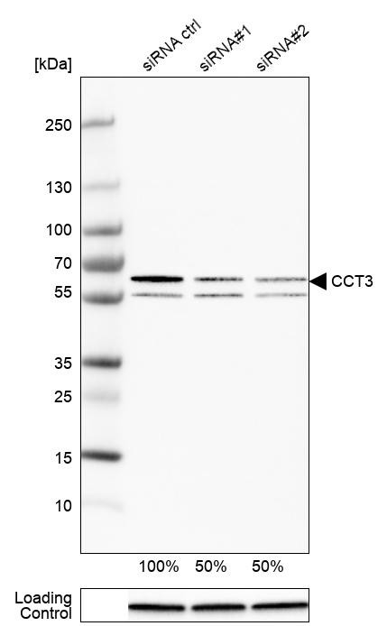 Western blot analysis in HEK293 cells transfected with control siRNA, target specific siRNA probe #1 and #2, using Anti-CCT3 antibody. Remaining relative intensity is presented. Loading control: Anti-GAPDH.