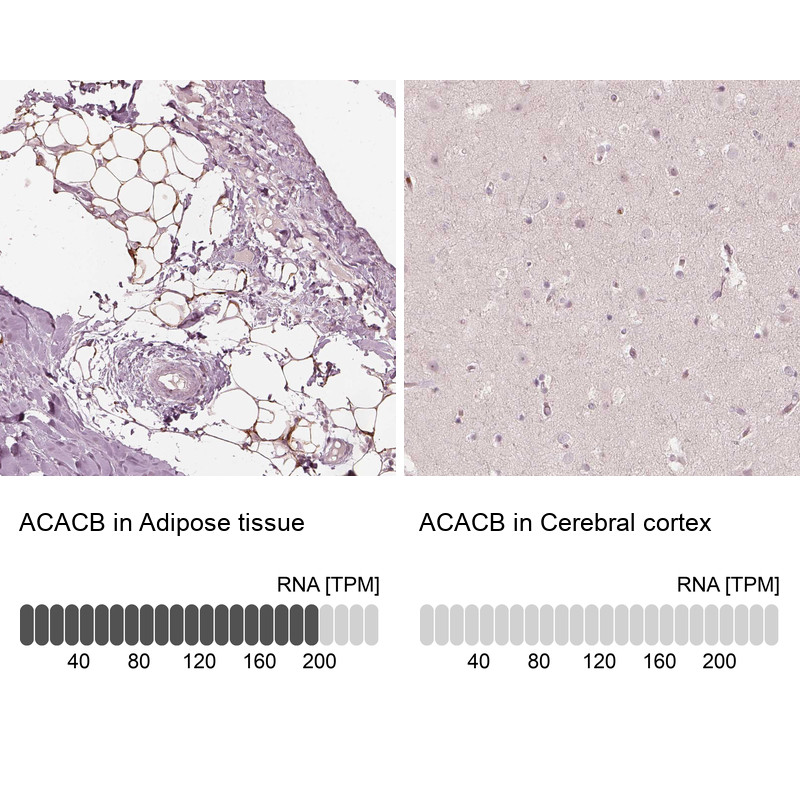 Immunohistochemistry analysis in human adipose tissue and cerebral cortex tissues using HPA006554 antibody. Corresponding ACACB RNA-seq data are presented for the same tissues.