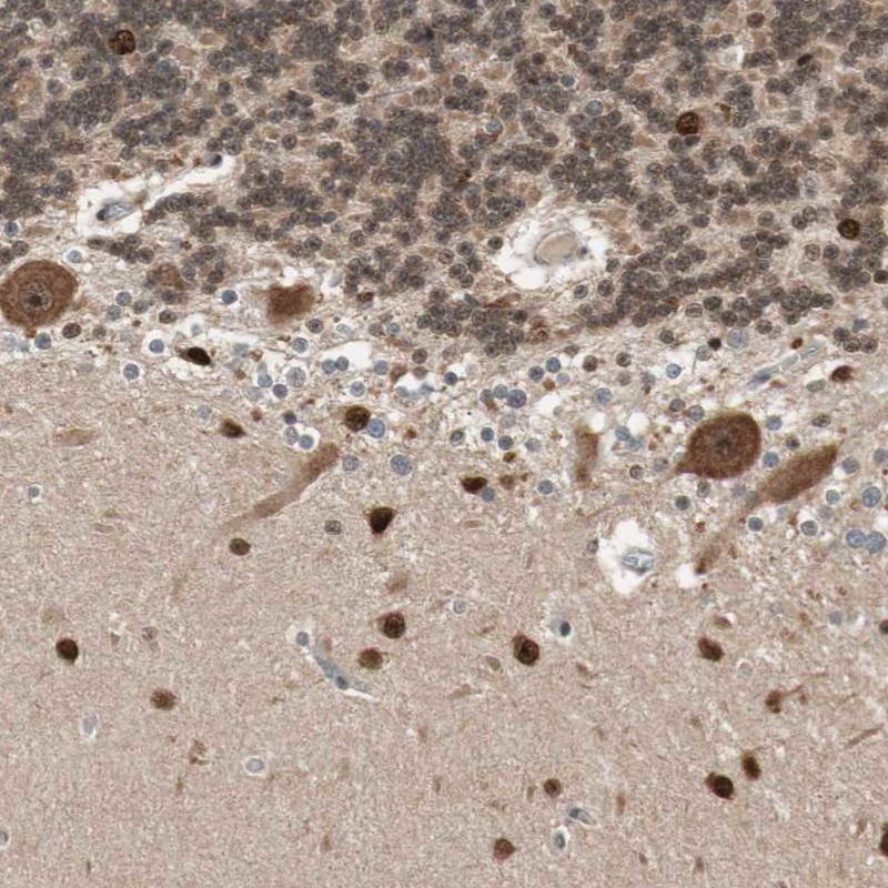 Immunohistochemical staining of human cerebellum shows strong nuclear positivity in cells in molecular layer.