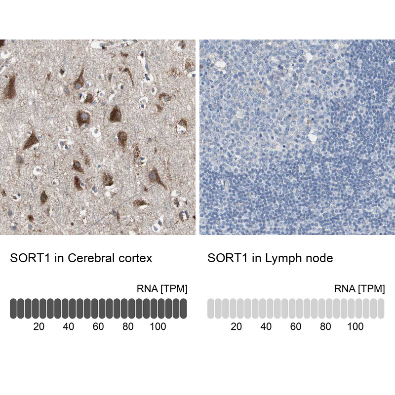 Immunohistochemistry analysis in human cerebral cortex and lymph node tissues using HPA006889 antibody. Corresponding SORT1 RNA-seq data are presented for the same tissues.