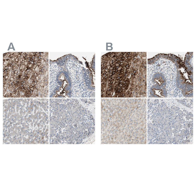Immunohistochemical staining of human adrenal gland, endometrium, liver and pancreas using Anti-ALPL antibody HPA007105 (A) shows similar protein distribution across tissues to independent antibody HPA008765 (B).
