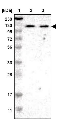 Lane 1: Marker [kDa] 230, 130, 95, 72, 56, 36, 28, 17, 11<br/>Lane 2: Human cell line RT-4<br/>Lane 3: Human cell line U-251MG sp