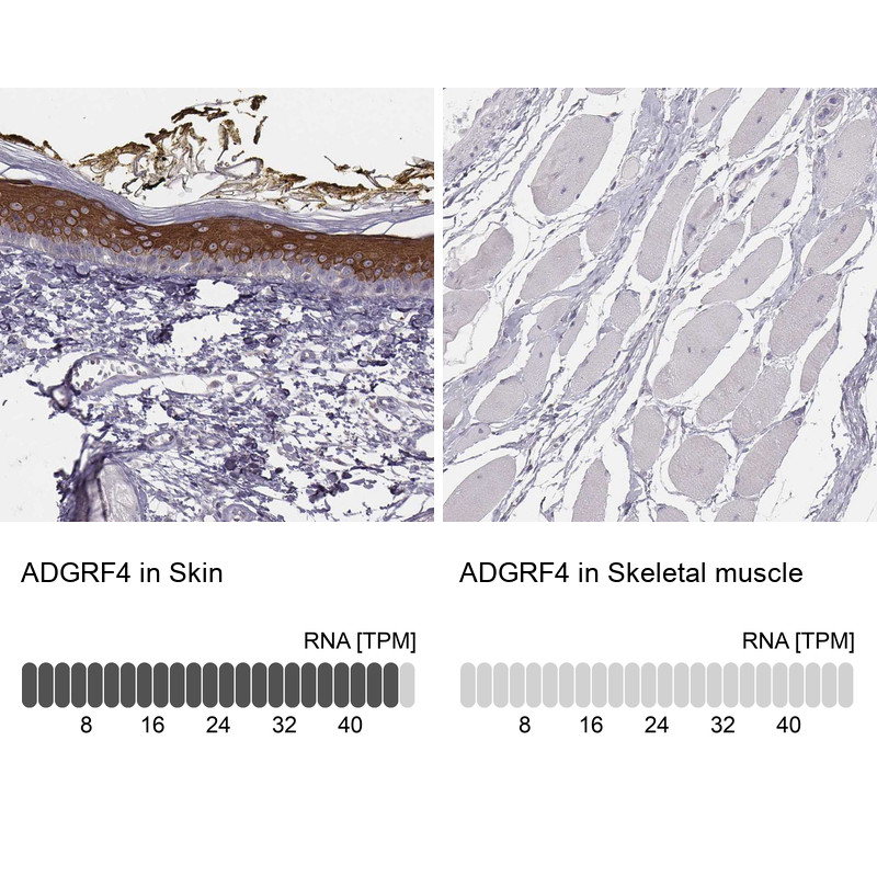 Immunohistochemistry analysis in human skin and skeletal muscle tissues using HPA007131 antibody. Corresponding ADGRF4 RNA-seq data are presented for the same tissues.