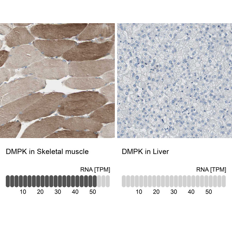 Immunohistochemistry analysis in human smooth muscle and liver tissues using Anti-DMPK antibody. Corresponding DMPK RNA-seq data are presented for the same tissues.