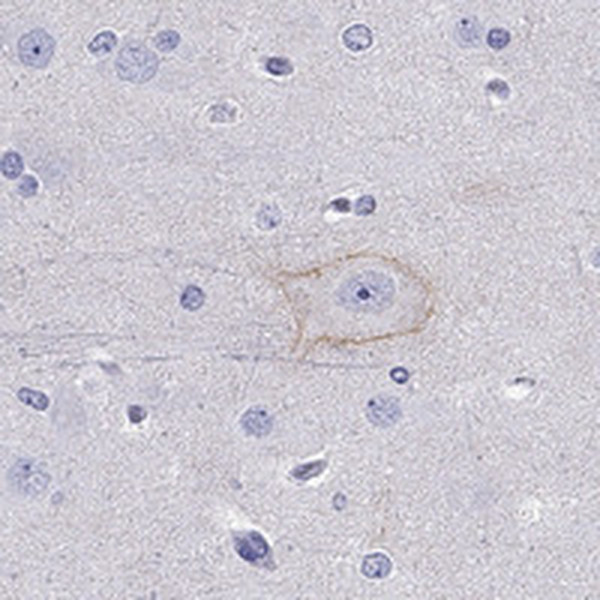 Immunohistochemical staining of human cerebral cortex shows membranous positivity in neuronal cells.